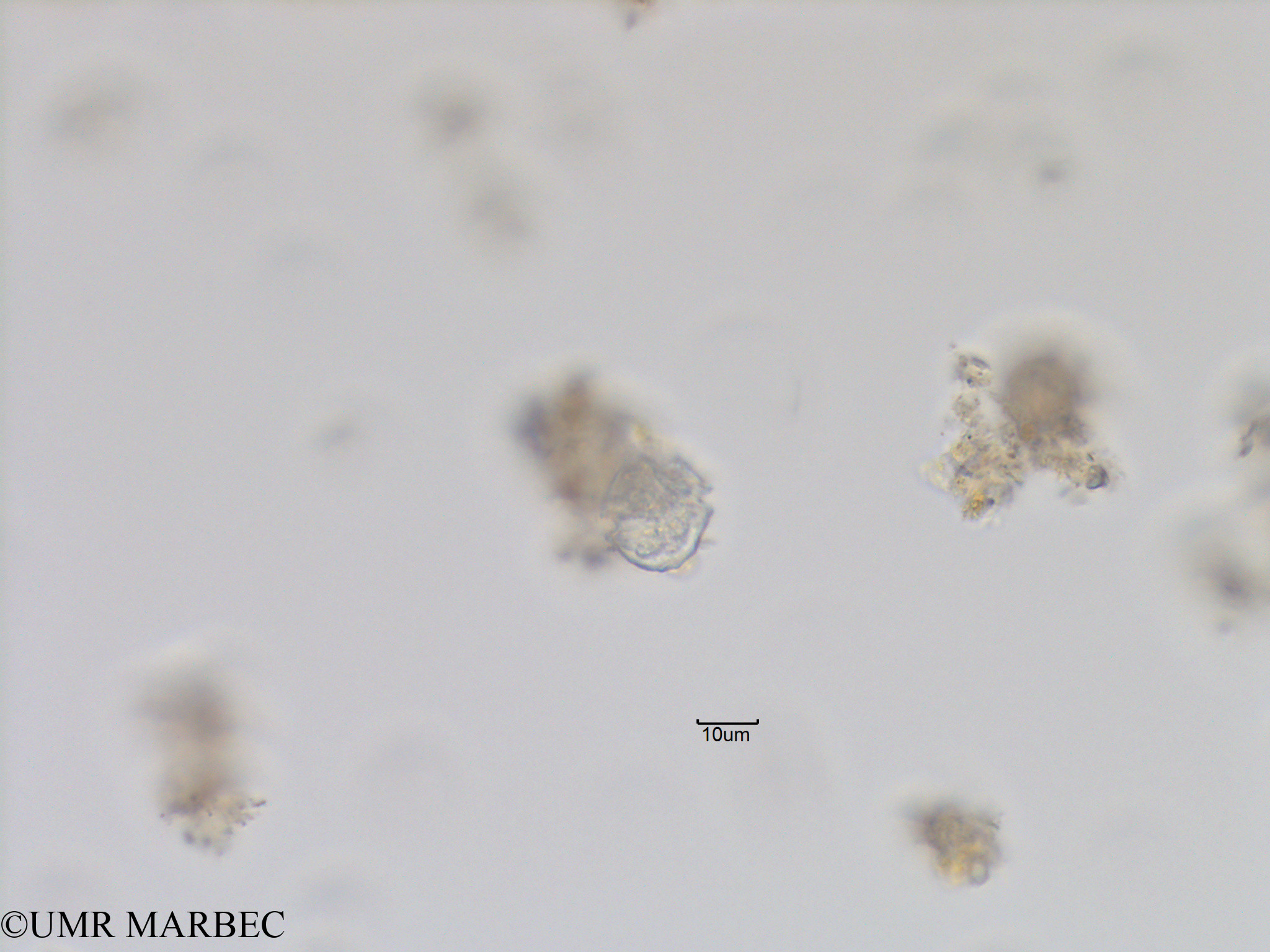 phyto/Bizerte/bizerte_lagoon/RISCO November 2015/Alexandrium sp12 (ancien Alexandrium sp12 -Lagune_T5_C3_cf alex-3).tif(copy).jpg